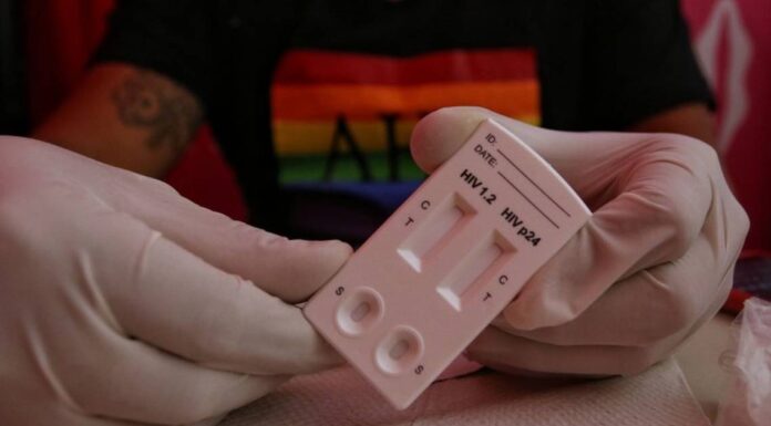 Hidalgo acumula más de 5 mil casos de VIH