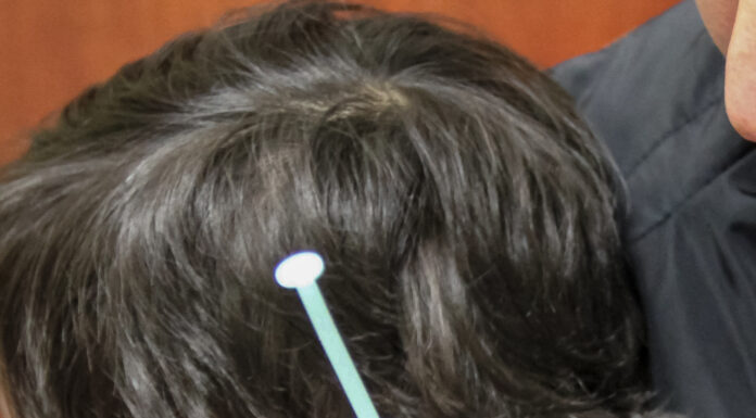 En Hidalgo, en lo que va del año, no se han presentado casos de sarampión