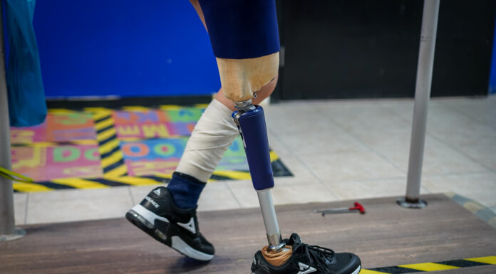 Laboratorio de Órtesis y Prótesis del DIFH transforma la vida de hidalguenses que viven con discapacidad