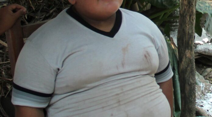 Panorama estatal del sobrepeso y obesidad