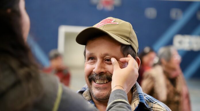 Concluye Jornada Médica Gratuita de Prótesis Ocular «DIF Hidalgo – UNAM»