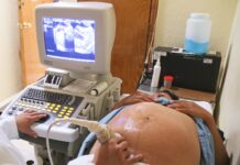 Hidalgo avanza contra el embarazo adolescente